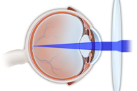 Eye Exams | Eye Treatment | Sierra Vista | Benson